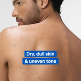 Mixa Niacinamide Bright Body Lotion - For Dry & Dull Skin in Need of Unifying - With Shea Butter, Niacinamide & Vitamin C