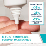 Blemish Control Gel Facial Moisturizer For Acne & Blemishes with Glycolic Acid and Lactic Acid AHA/BHA