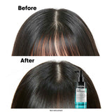 Serie Expert Scalp Advanced Anti-Oiliness Serum