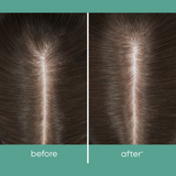 Aminexil Hair Treatment Tonic