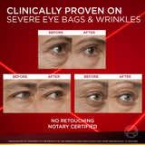 Revitalift Laser Instant Eye Bag Eraser