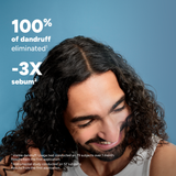 Squanorm Anti-Dandruff Treatment Shampoo - Oily Dandruff