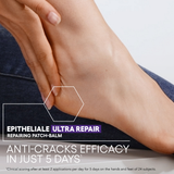 Epithelliale Ultra Repair Balm Patch