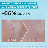 Super UV Anti-Acne SPF50+ Sunscreen– 12H Oil Control
