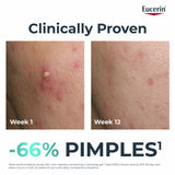 Eucerin DermoPure Clinical Triple Action Serum