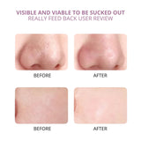 Blackhead Removal Camera Visual & Multifunctional Device