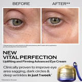 Vital Perfection Advanced Eye Cream