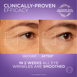 Hyaluron Expert Eye Serum, Targeted Eye Contour Treatment for Hydration and Plump, with Hyaluronic Acid and Caffeine, 20ml