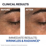 Age Absolu Eye Contour