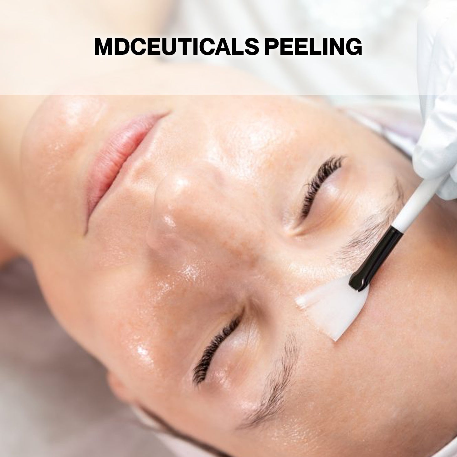 MD Ceuticals Peel