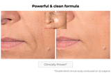 Microneedling Anti-Aging Patch