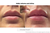Microneedling Lip Patch