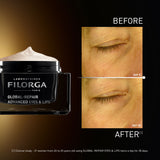 Global-Repair Advanced Eyes & Lips
