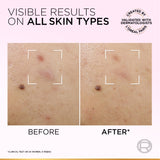 L’Oréal Paris Glycolic-Bright Anti-Dark Spot Exfoliant Peel 15% AHA + BHA + PHA + Niacinamide 25ml.