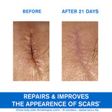 Bariéderm Cica-Cream with Copper-Zinc - Weakened Irritated Skin