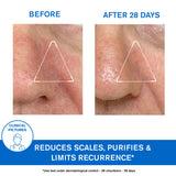 DS Regulating Soothing Emulsion - Skin Prone to Irritations Redness and Scales