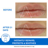 DS Regulating Soothing Emulsion - Skin Prone to Irritations Redness and Scales