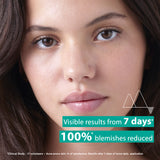 Hyséac - New Skin Serum