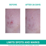 Hyséac 3-Regul Global Skin-Care - Oily Skin with Blemishes