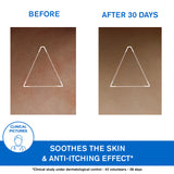 Xémose Lipid-Replenishing Anti-Irritation Cerat - Extreme Skin Dryness - Skin Prone to Atopy