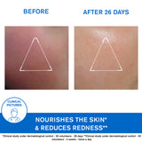 Xémose Face Cream - Very Dry Skin or Prone to Atopy