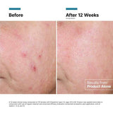 Advanced RGN-6 Regenerative Cream
