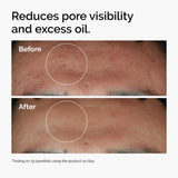 Niacinamide 10% + Zinc 1% Serum