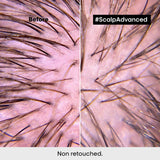 L'Oréal Professionnel Serie Expert Scalp Advanced Anti-Discomfort Intense Soother Treatment - Skin Society {{ shop.address.country }}
