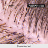 L'Oréal Professionnel Serie Expert Scalp Advanced Anti-Oiliness Dermo-Purifier Shampoo - Skin Society {{ shop.address.country }}