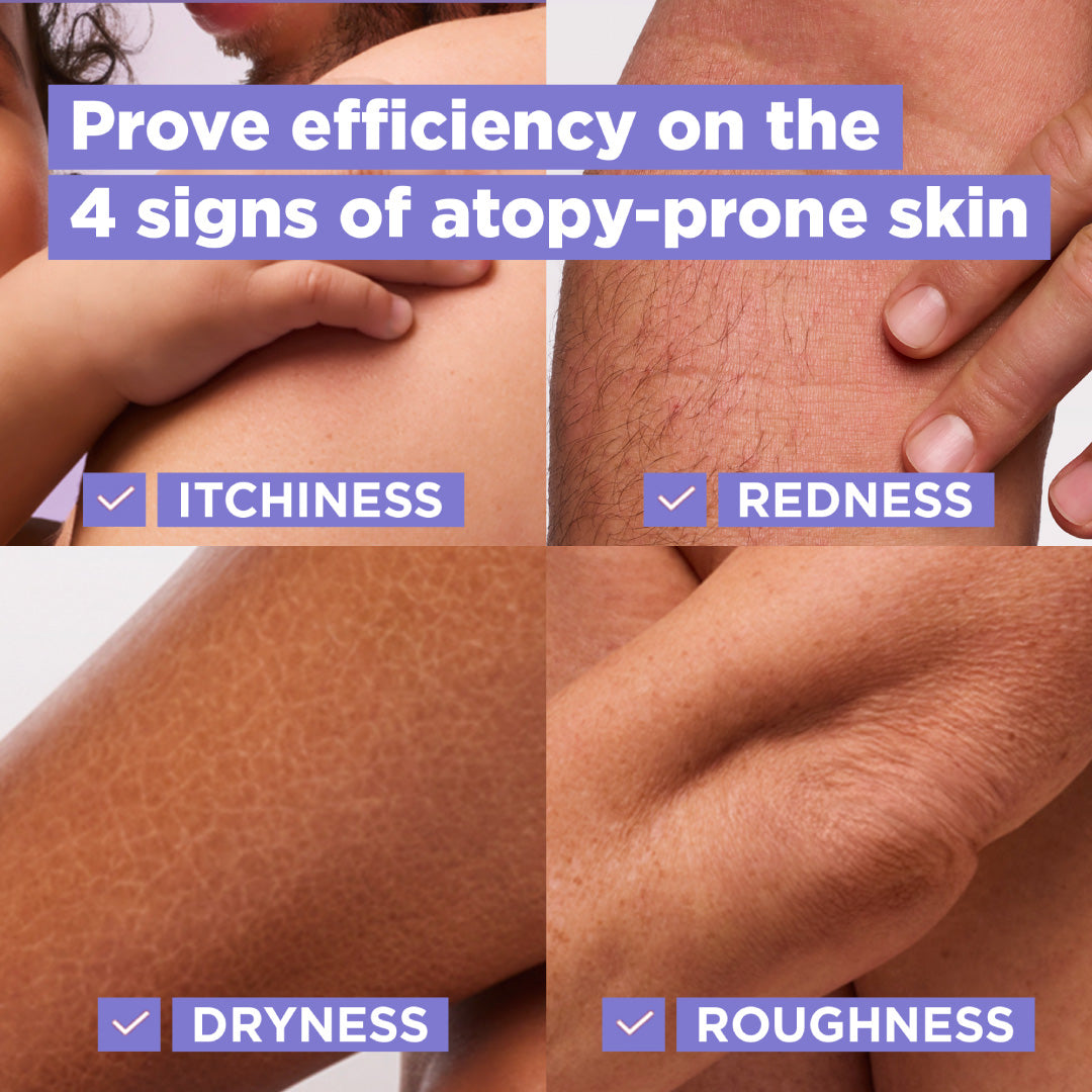 Mixa Panthenol Comfort Cream Jar - Anti-Scratching Cream - For Dry Skin, Atopy Prone Skin and Eczema - For Face, Hands & Body