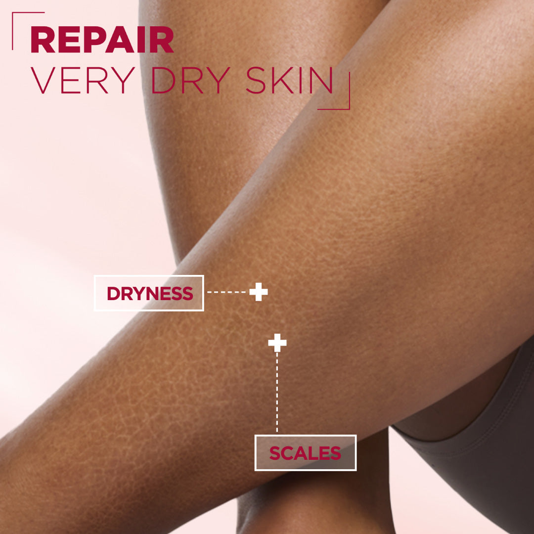 Mixa Urea Cica Repair Cream Jar - For Keratosis Pilaris, Dry Rough Fragile Skin & Tiny Reddish Bumps - For Face, Hands & Body