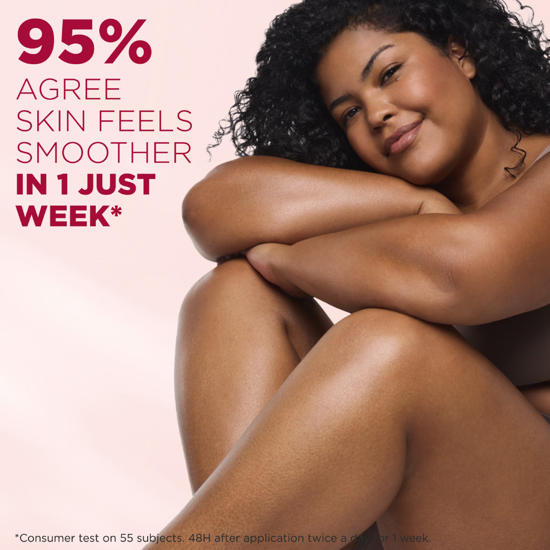 Mixa Urea Cica Repair Body Lotion - For Keratosis Pilaris, Dry Rough Fragile Skin & Tiny Reddish Bumps