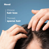 Anaphase+ Anti-Hair Loss Complement Shampoo