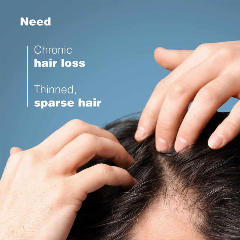 Anaphase+ Anti-Hair Loss Complement Shampoo