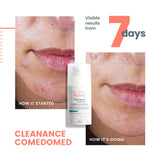 Cleanance Comedomed Anti-Blemishes Concentrate - Acne-Prone Skin