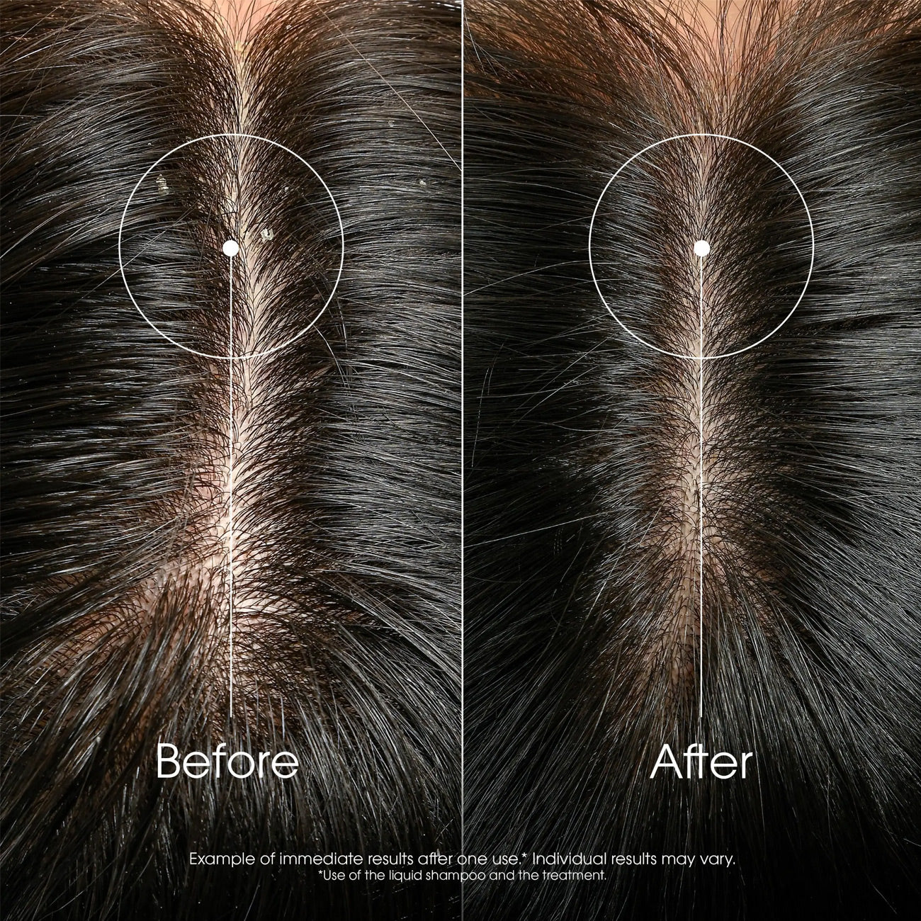Anti-Dandruff Rebalancing & Treating Shampoo With Galangal
