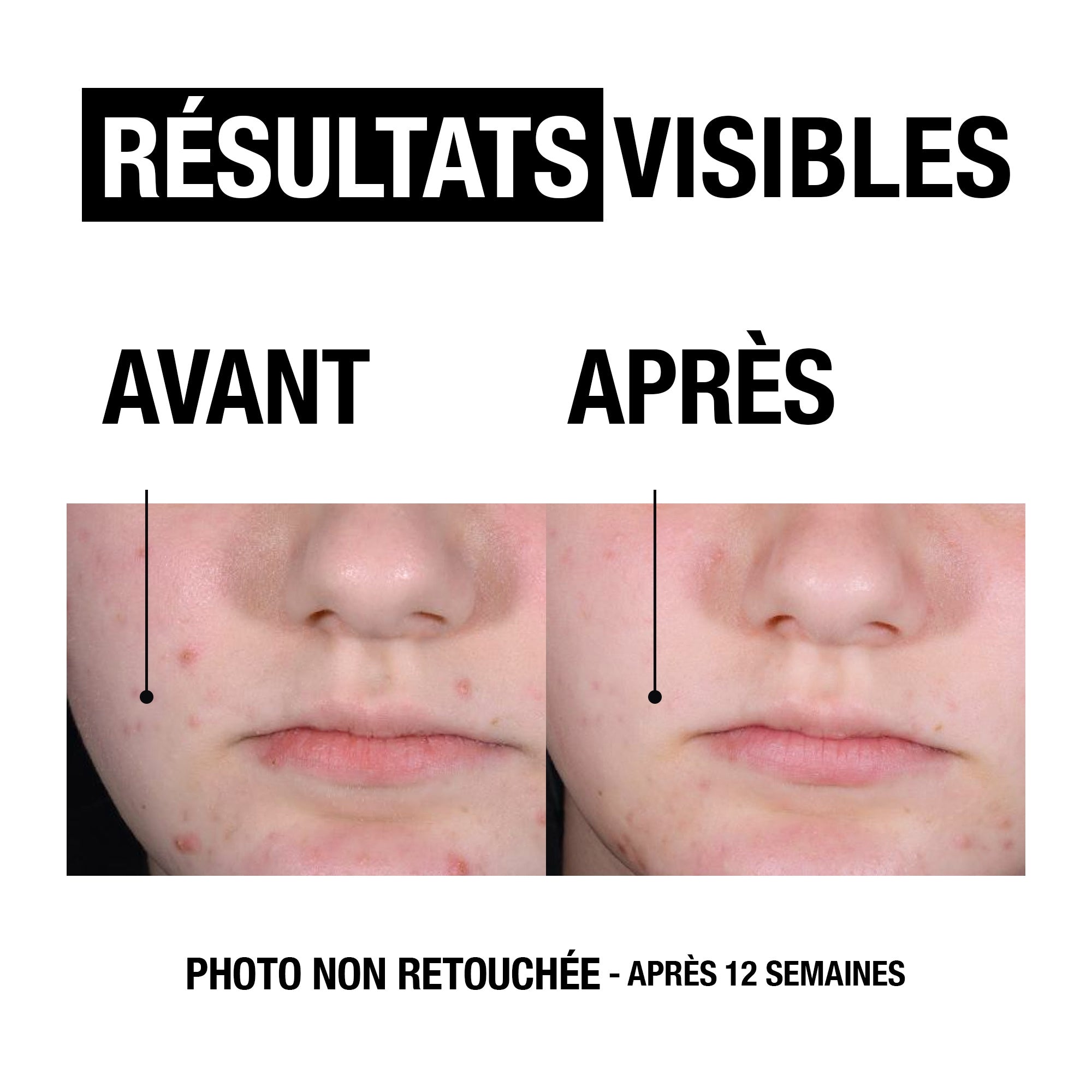 Spot Control+ Gel Hydrato 4% Niacinamide + Panthenol