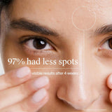 Spot Controlling Facial Wash, Oil Free