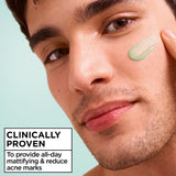 Salicylic Fresh & Matte Moisturizer Cream