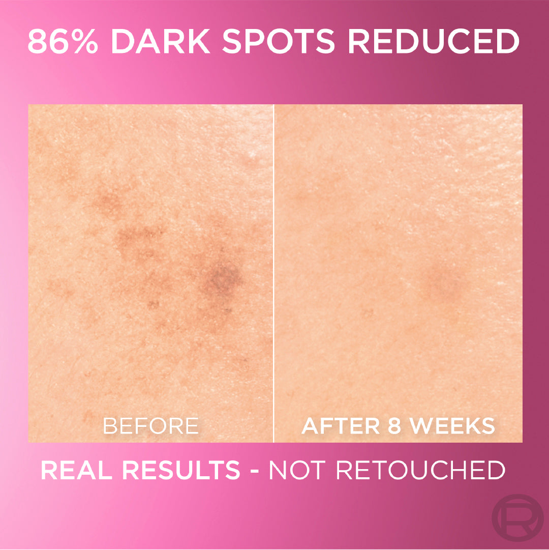 Glycolic Bright Face Serum, With 8% [Melasyl ™ + Glycolic Acid + Niacinamide], for Dark Spots and Brightening 30ml