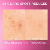 Glycolic Bright Face Serum, With 8% [Melasyl ™ + Glycolic Acid + Niacinamide], for Dark Spots and Brightening 30ml