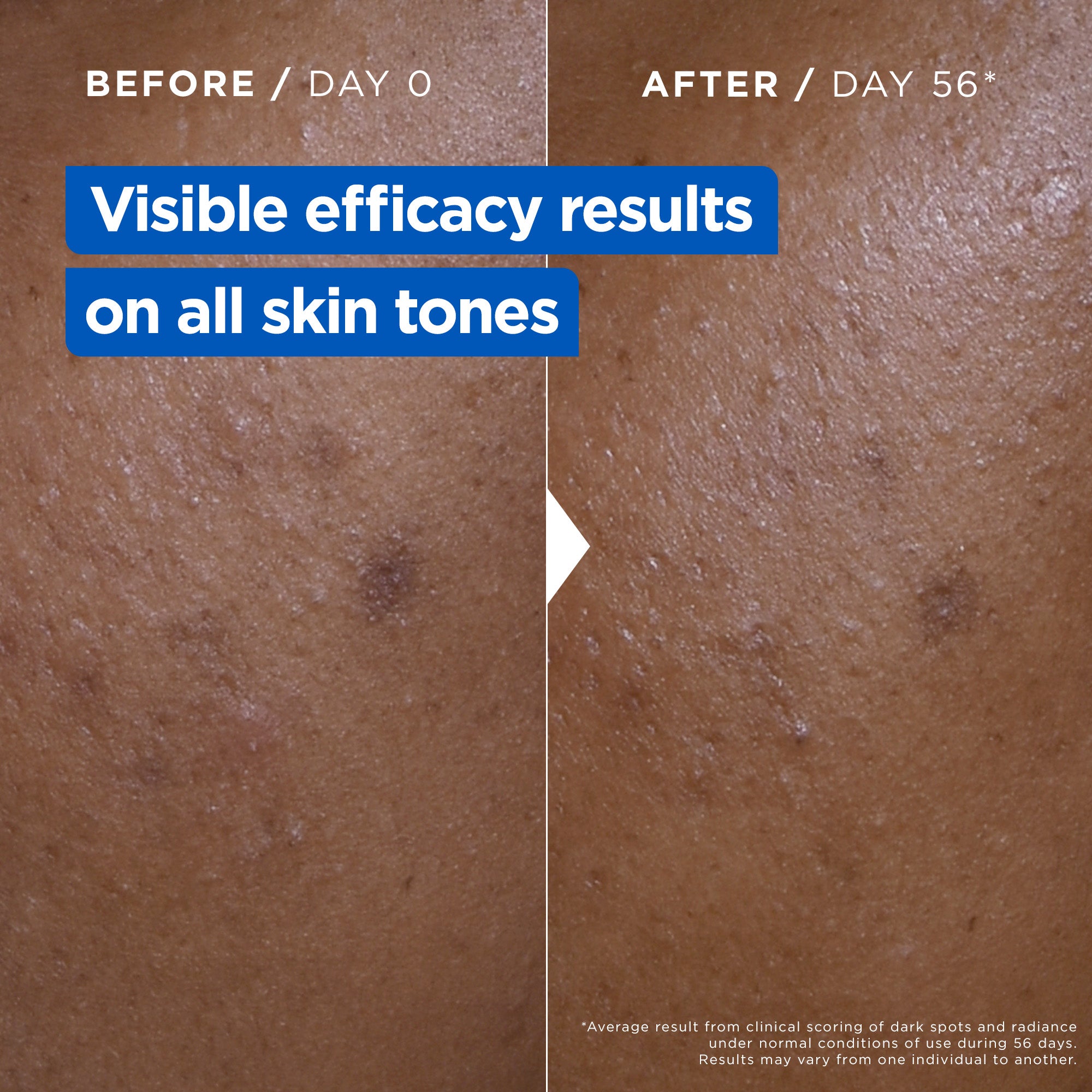 Mixa Niacinamide Bright Moisturising Anti-Dark Spot Cream