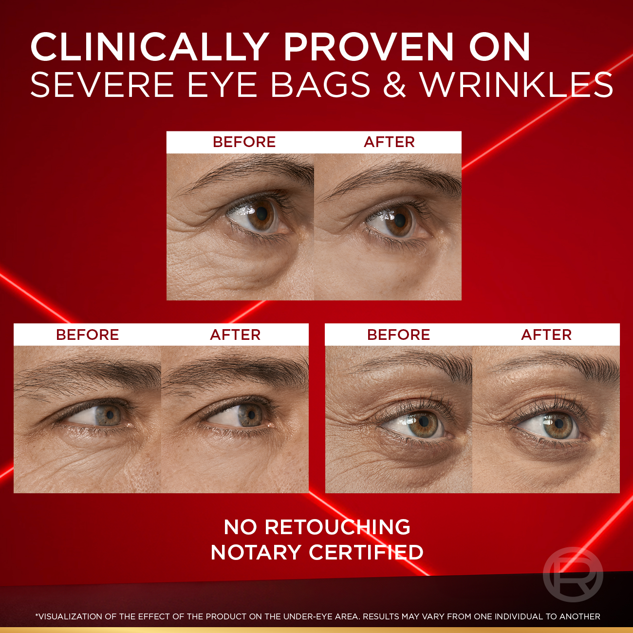 Revitalift Laser Instant Eye Bag Eraser