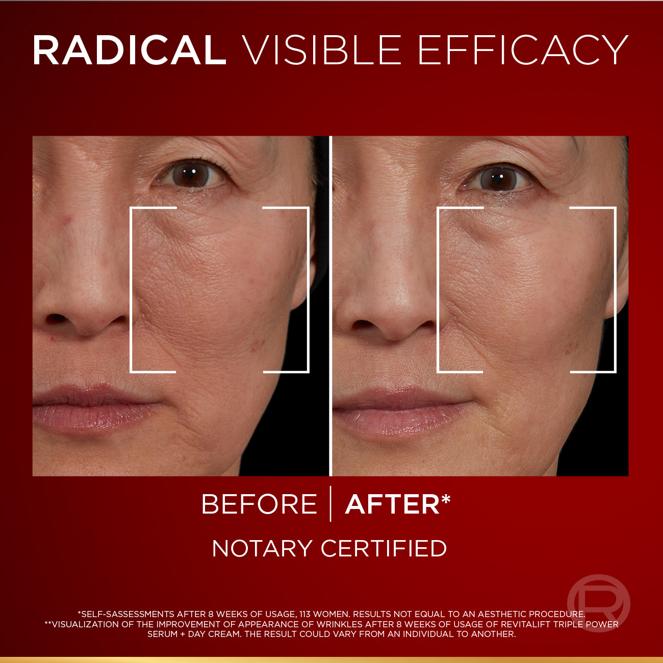 L’Oréal Paris Revitalift Triple Power Age-Correcting™ Serum with Tri-peptides, Hyaluronic Acid, and Vitamin C to Hydrate, Tone, and Firm Skin, 30ml.