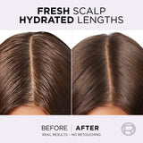 L'Oréal Paris, Hyaluron Pure Oil Erasing Scalp Serum with Salicylic Acid, for Oily Roots and Dehydrated Lengths