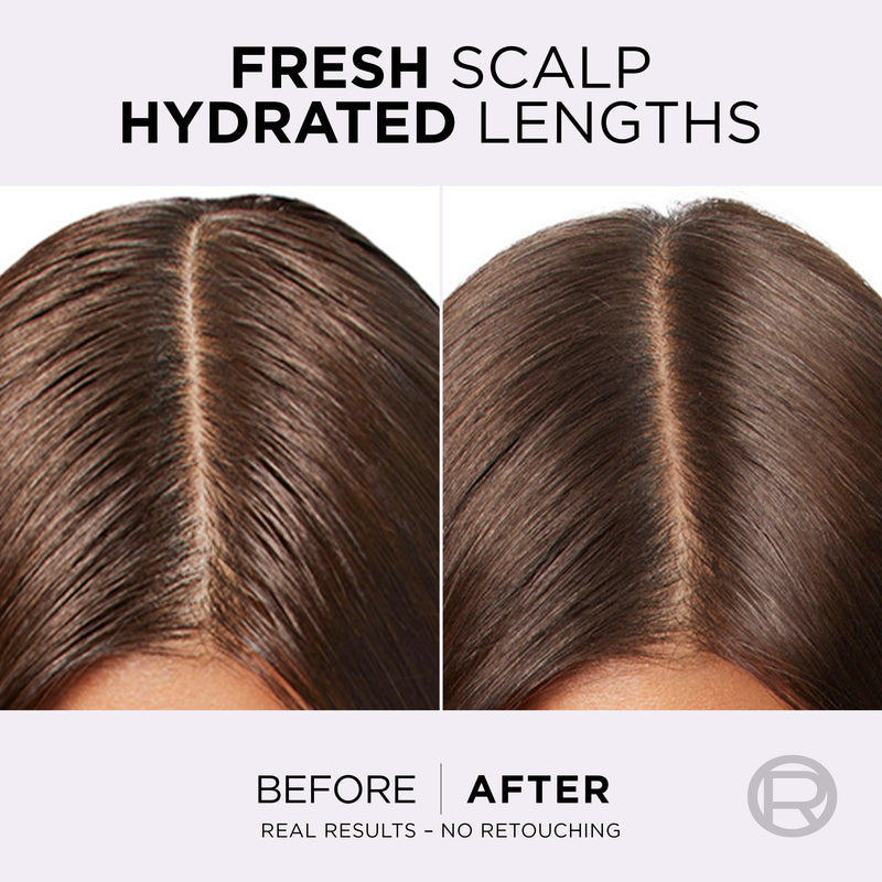 L'Oréal Paris, Hyaluron Pure Oil Erasing Scalp Serum with Salicylic Acid, for Oily Roots and Dehydrated Lengths