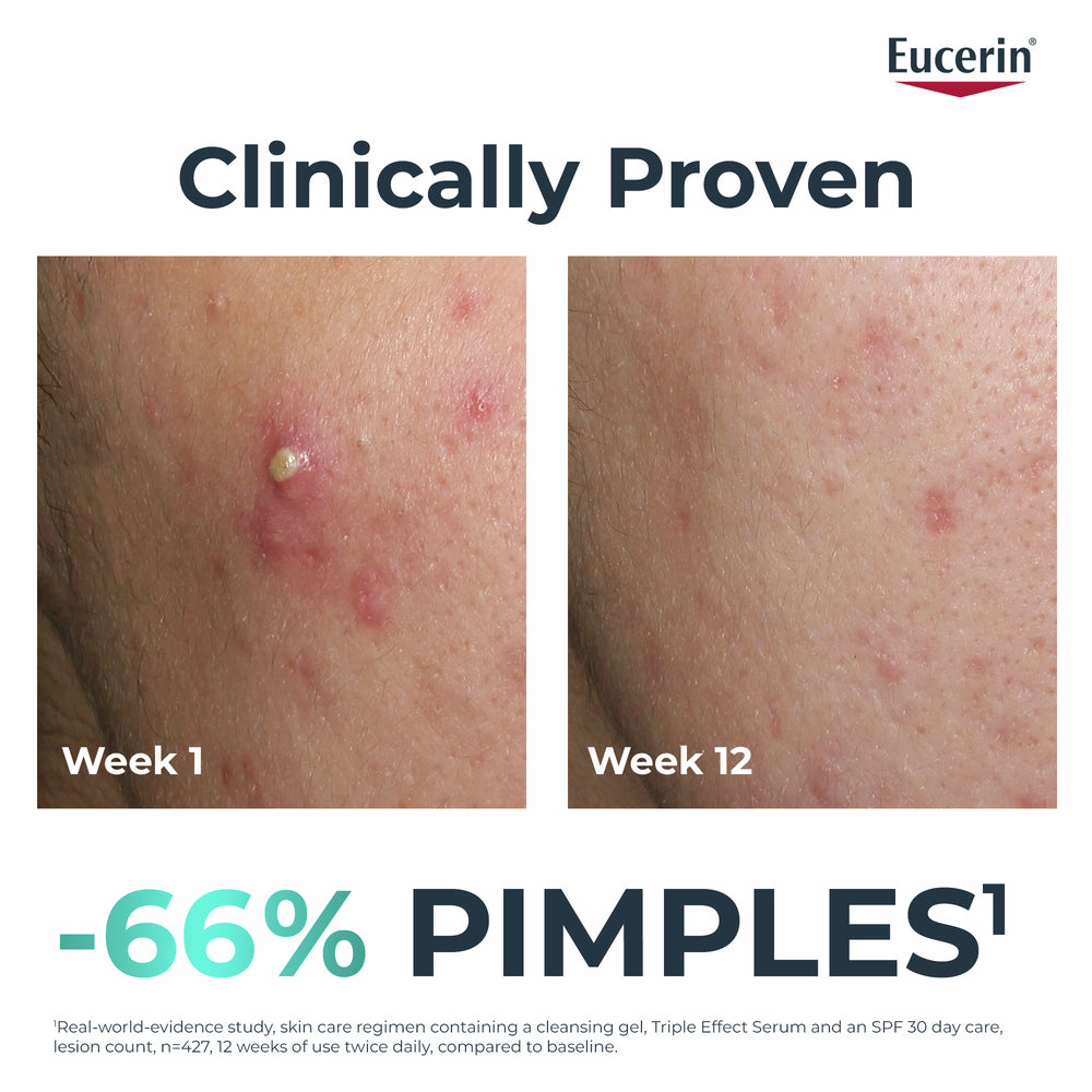 Eucerin DermoPure Clinical Triple Action Serum