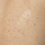 Salicylic Acid 0.5% Body Serum