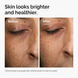 Antioxidant & Radiance Serum