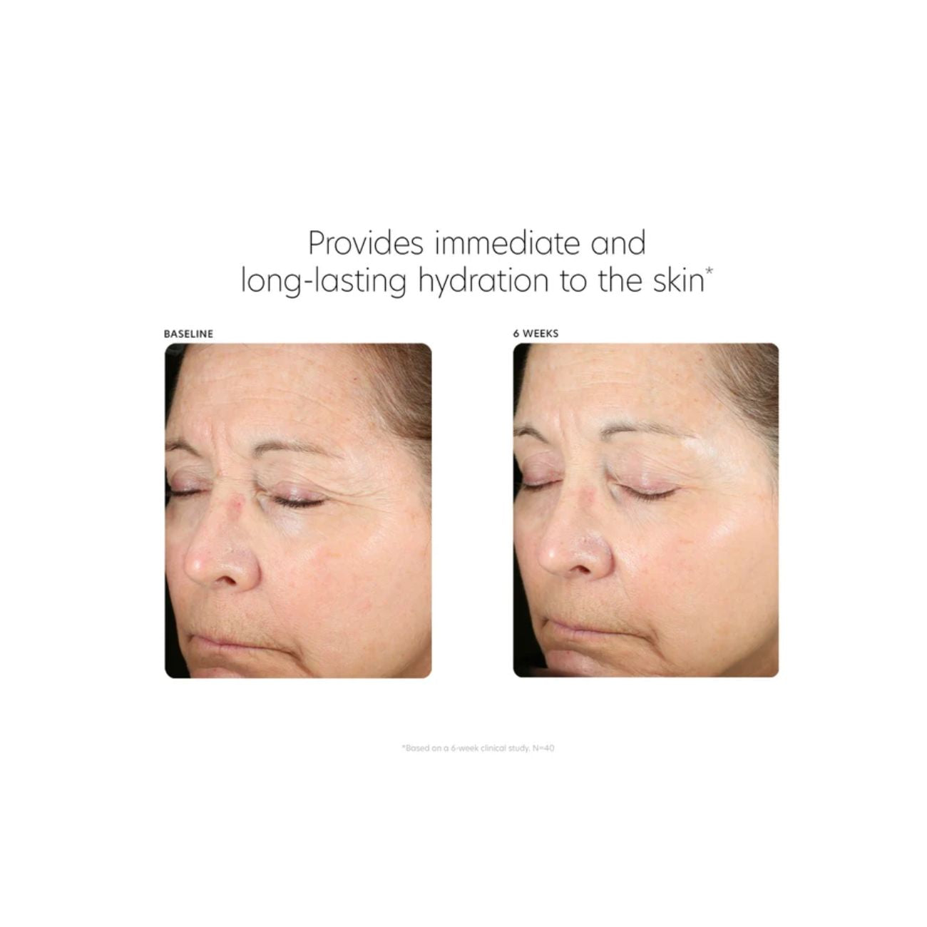 PCA Skin Hyaluronic Acid Boosting Serum